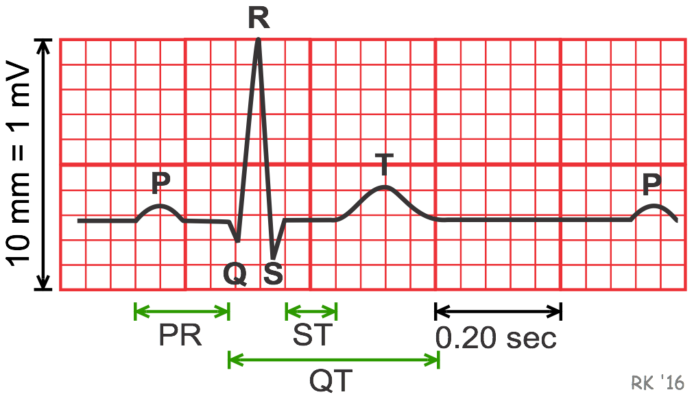 labeled EKG diagram