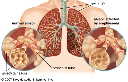 Alveoli2.png