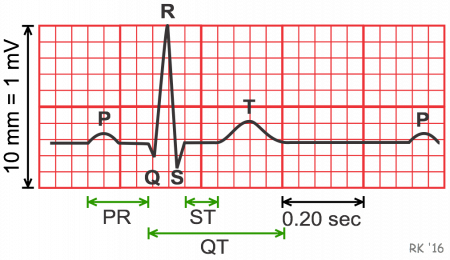 labeled EKG diagram